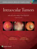 Intraocular Tumors: An Atlas and Textbook