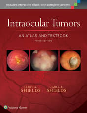 Intraocular Tumors: An Atlas and Textbook