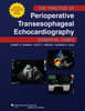 VitalSource e-Book for The Practice of Perioperative Transesophageal Echocardiography: Essential Cases