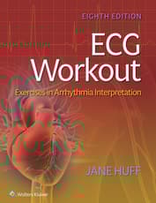 ECG Workout