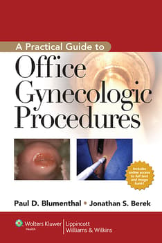 Practical Guide to Office Gynecologic Procedures