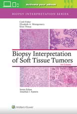 Biopsy Interpretation of Soft Tissue Tumors: Print + eBook with Multimedia