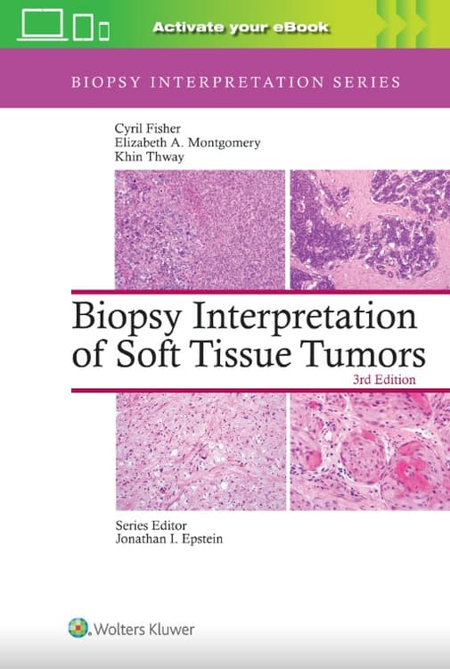 Biopsy Interpretation of Soft Tissue Tumors: Print + eBook with Multimedia