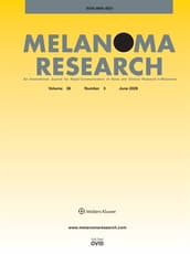 Melanoma Research
