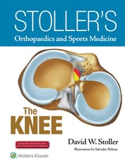 Stoller's Orthopaedics and Sports Medicine: The Knee