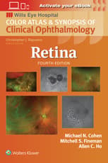 Retina