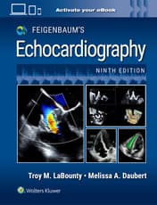 Feigenbaum's Echocardiography: Print + eBook with Multimedia