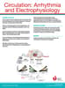 Circulation: Arrhythmia and Electrophysiology Online