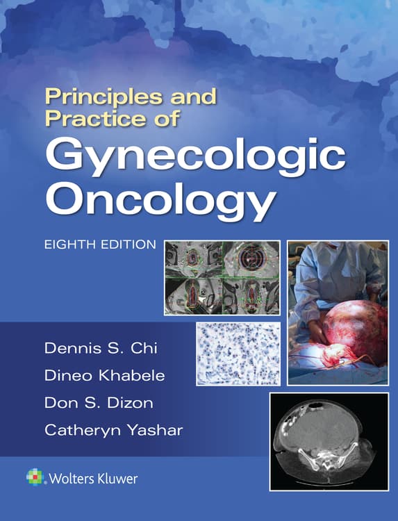 Principles and Practice of Gynecologic Oncology