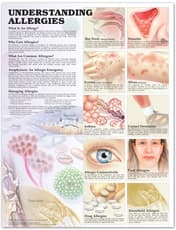 Understanding Allergies Anatomical Chart