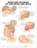 Whiplash Injuries of the Head and Neck Anatomical Chart