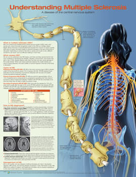 Understanding Multiple Sclerosis Anatomical Chart