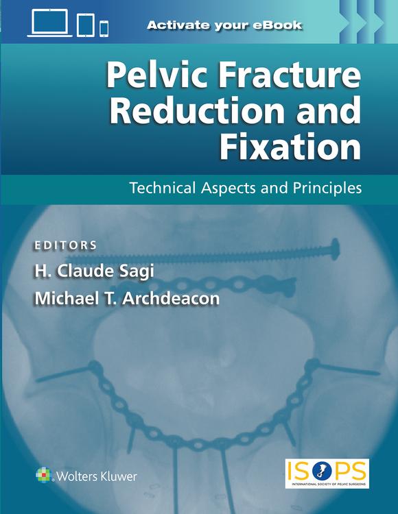 Pelvic Fracture Reduction and Fixation: Technical Aspects and Principles