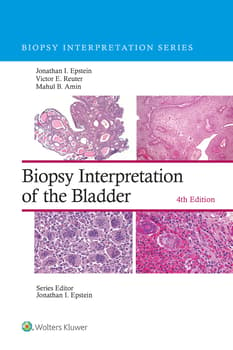 Biopsy Interpretation of the Bladder: eBook with Multimedia