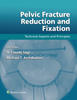 Pelvic Fracture Reduction and Fixation: Technical Aspects and Principles