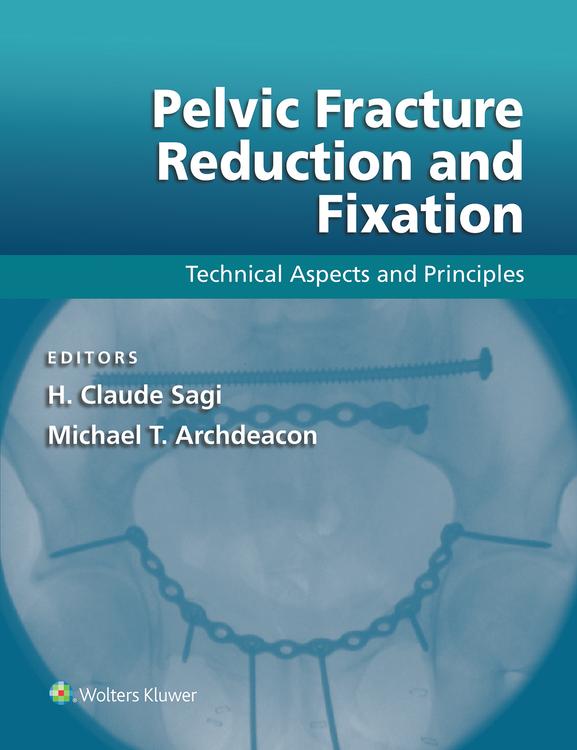 Pelvic Fracture Reduction and Fixation: Technical Aspects and Principles