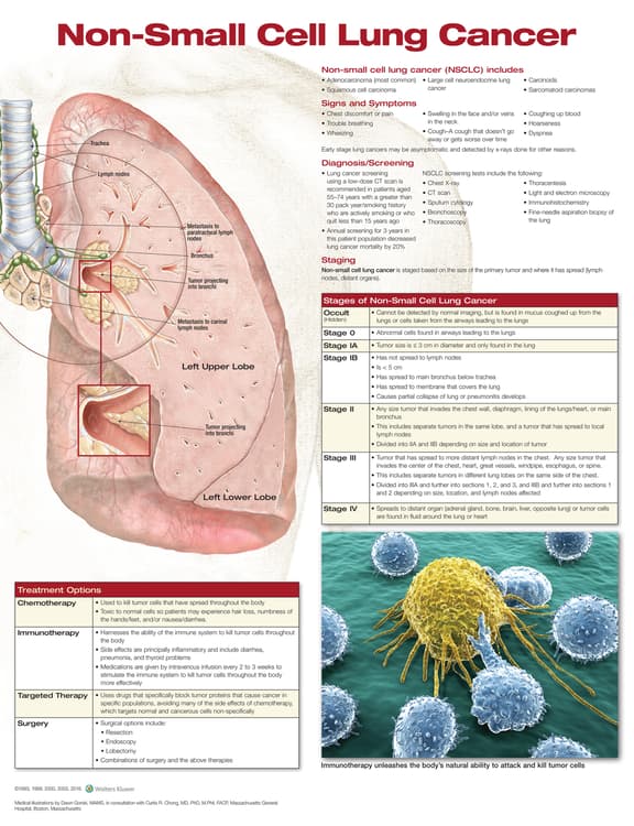 Non-Small Cell Lung Cancer