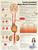 Understanding High Blood Pressure