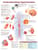 Understanding Hypertension Anatomical Chart