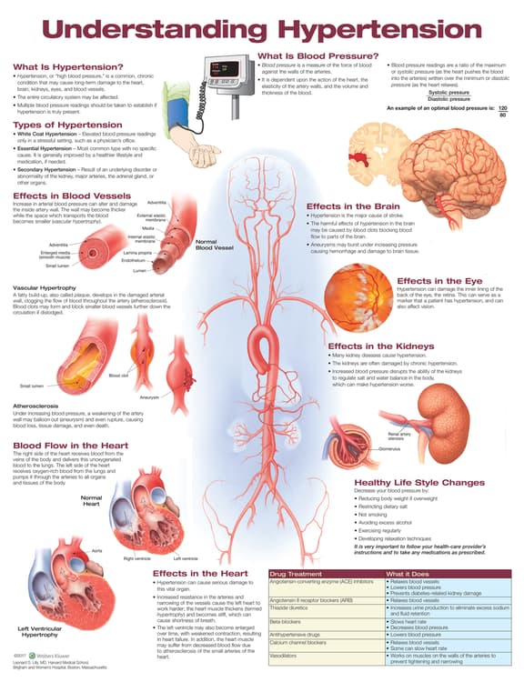 Understanding Hypertension Anatomical Chart