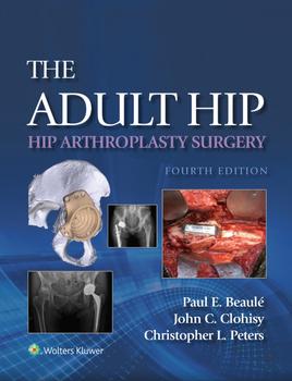 The Adult Hip: Hip Arthroplasty Surgery eBook with Multimedia
