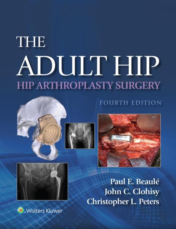 The Adult Hip: Hip Arthroplasty Surgery eBook with Multimedia
