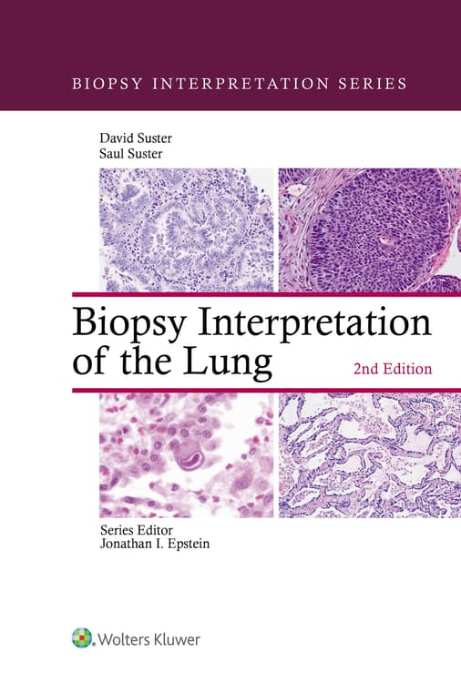 Biopsy Interpretation of the Lung