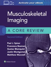 Musculoskeletal Imaging: A Core Review