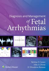 Diagnosis and Management of Fetal Arrhythmias