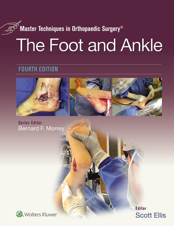 Master Techniques in Orthopaedic Surgery: The Foot and Ankle: eBook with Multimedia