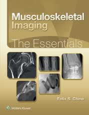 Musculoskeletal Imaging: The Essentials