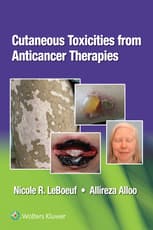 Cutaneous Toxicities from Anticancer Therapies