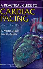 Practical Guide to Cardiac Pacing