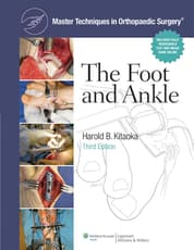 Master Techniques in Orthopaedic Surgery: The Foot and Ankle