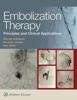 Embolization Therapy: Principles and Clinical Applications