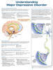 Understanding Major Depressive Disorder