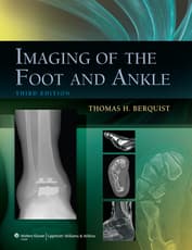 VitalSource E-book for Imaging of the Foot and Ankle