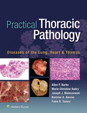 Practical Thoracic Pathology