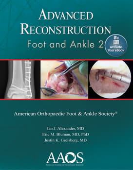 Advanced Reconstruction: Foot and Ankle 2: Print + Ebook