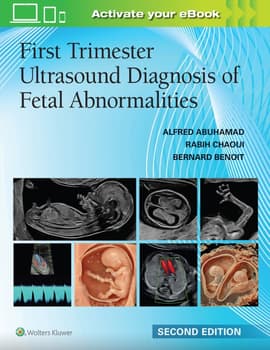 First Trimester Ultrasound Diagnosis of Fetal Abnormalities