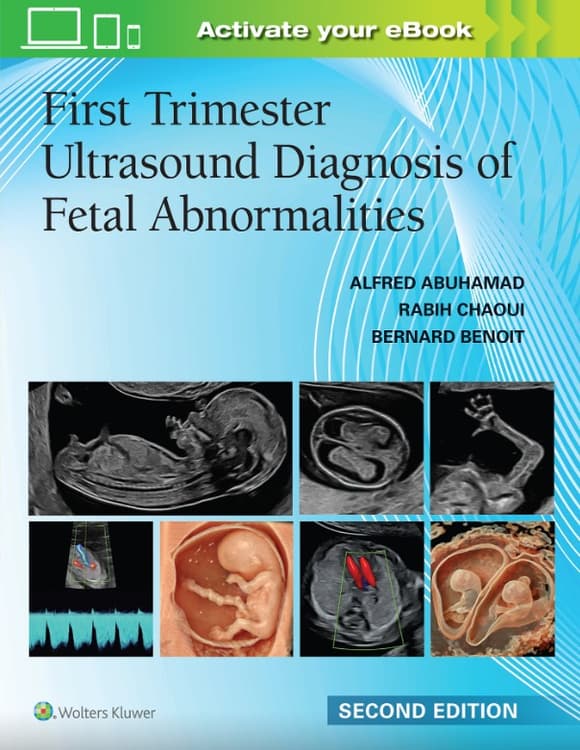 First Trimester Ultrasound Diagnosis of Fetal Abnormalities