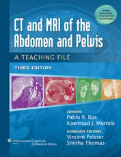 CT & MRI of the Abdomen and Pelvis