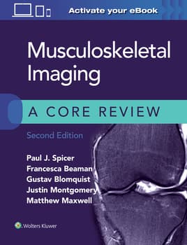 Musculoskeletal Imaging: A Core Review