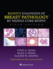 Rosen's Diagnosis of Breast Pathology by Needle Core Biopsy