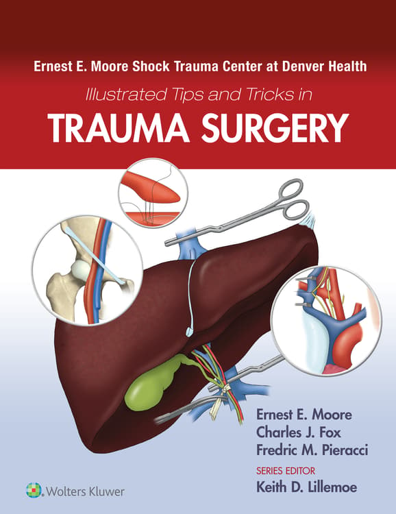 Ernest E. Moore Shock Trauma Center at Denver Health Illustrated Tips and Tricks in Trauma Surgery