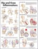 Hip and Knee Inflammations Anatomical Chart