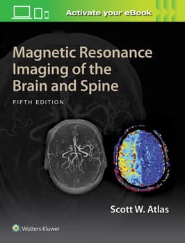 Magnetic Resonance Imaging of the Brain and