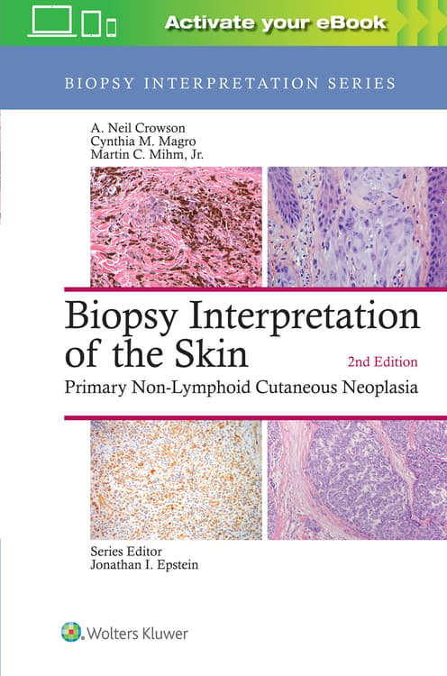 Biopsy Interpretation of the Skin