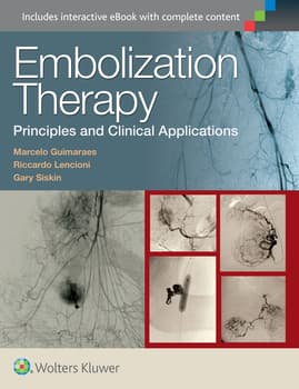 Embolization Therapy: Principles and Clinical Applications