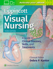 Lippincott Visual Nursing